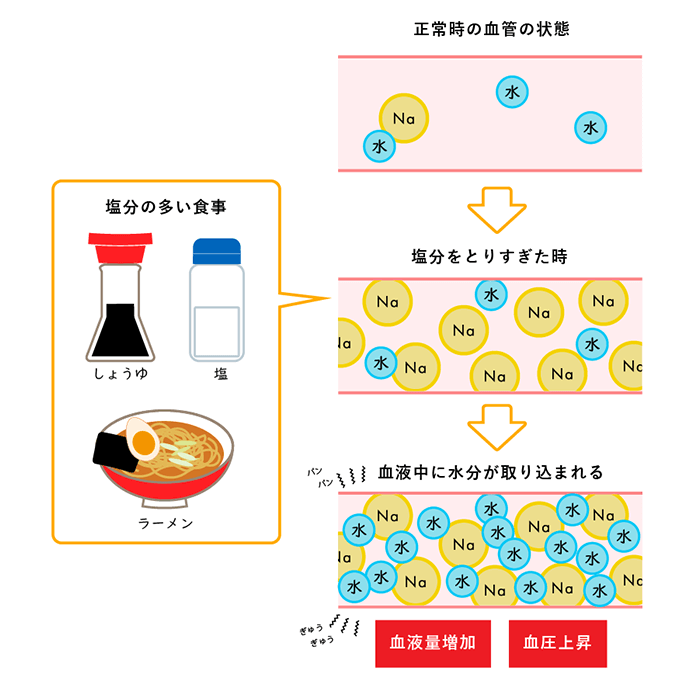 塩分の多い食事をとると、血管中にナトリウムイオンが大量に入り、水も取り込まれて血液量が増加し、血圧が上昇する様子を表した模式図